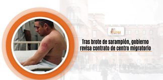 Tras pezón de sarampión, aposento revisa anuencia de núcleo nómade en tiendas en Texas Tras pezón de sarampión, aposento revisa anuencia de núcleo nómade en tiendas en Texas